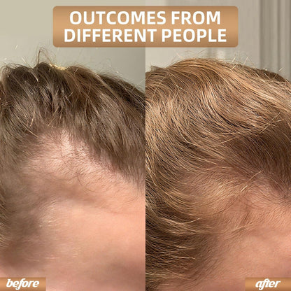 ReLuma™ Red Light Therapy Cap