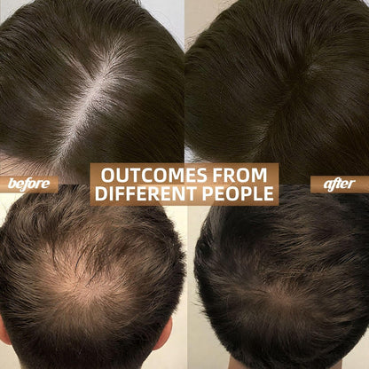 ReLuma™ Red Light Therapy Cap